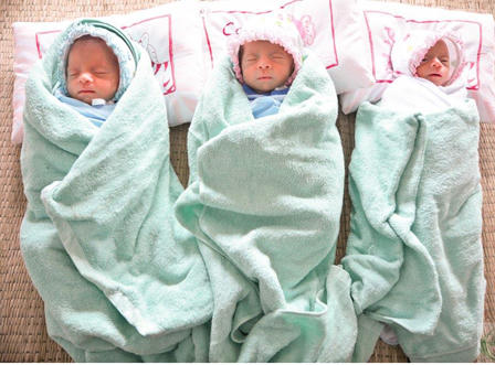 Hy hữu ca sinh 3 cùng trứng ở Nghệ An