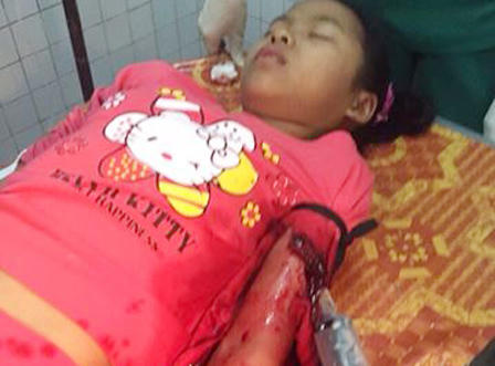 Bắt hai đối tượng đâm bị thương cháu bé 13 tuổi đêm Noel