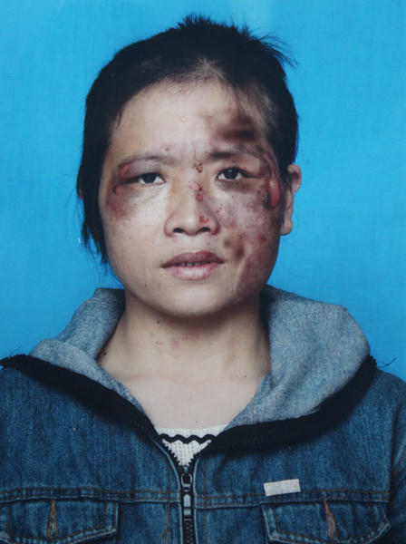 Bị chồng bạo hành dã man vì tham gia đa cấp?