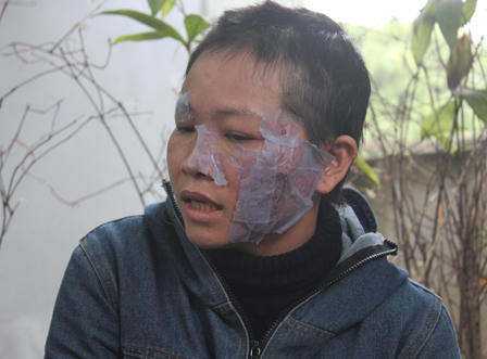 Bị chồng bạo hành dã man vì tham gia đa cấp?