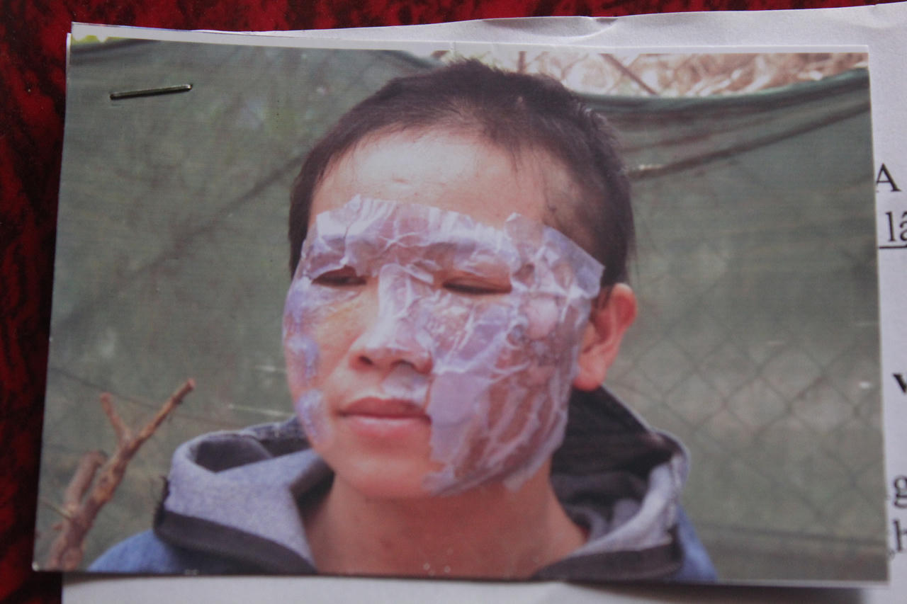 Bị chồng bạo hành dã man vì tham gia đa cấp?