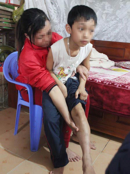 Hiệu trưởng bị tố đánh học sinh khuyết tật sợ đến... tè ra quần