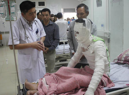 Thêm 3 công nhân Công ty gỗ phải chuyển ra viện Bỏng quốc gia