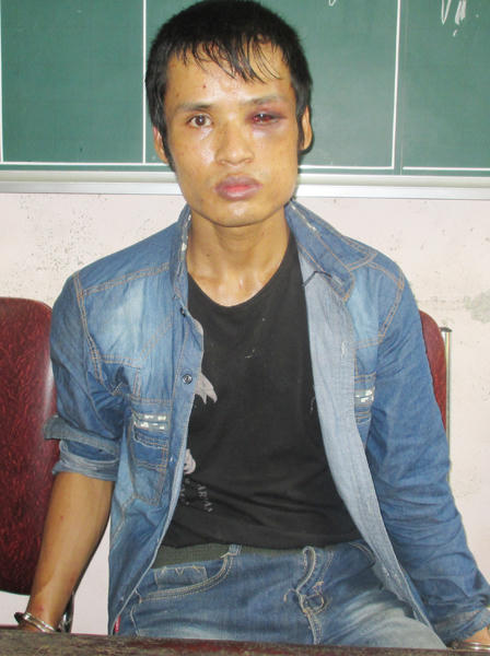 Hai cảnh sát bị 'trùm' ma túy nhiễm HIV dùng súng tấn công