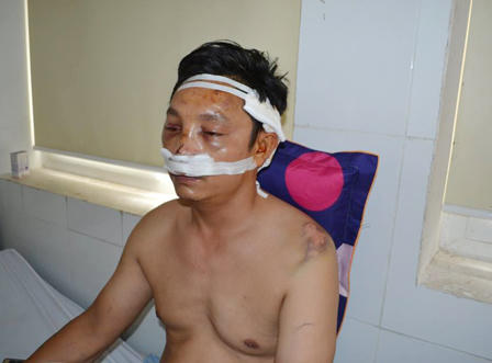 Làm rõ danh tính ba nghi can trong vụ nổ súng tại quán cà phê