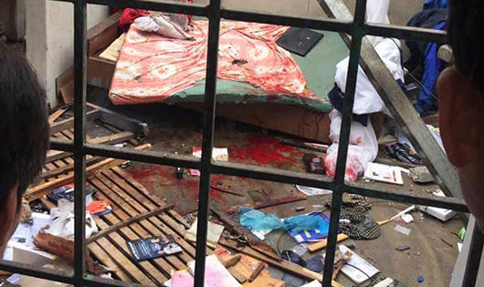 Vụ nổ lớn ở Nghệ An: Nam sinh viên phải tháo toàn bộ bàn tay phải, bỏng nặng toàn thân