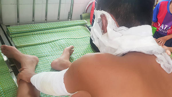 Cầu thủ giơ bóng bay che nắng, 4 người phải cấp cứu