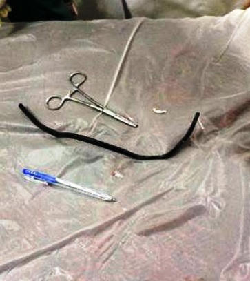 Nuốt dây diện lõi đồng vì lời thách đố của bạn