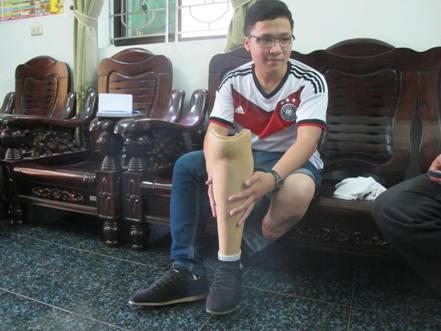 Nghị lực phi thường, của nam sinh chân giả “lai kinh ứng thí”