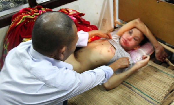 Đối tượng xâm hại bé trai khuyết tật bất ngờ nhắn tin trách móc gia đình?