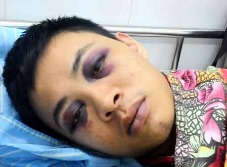 "Hỏi nhiều", y sỹ bị côn đồ đánh nhập viện