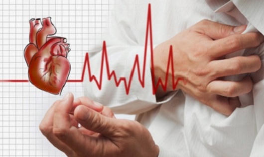 Nhận biết đúng về suy tim và nhồi máu cơ tim