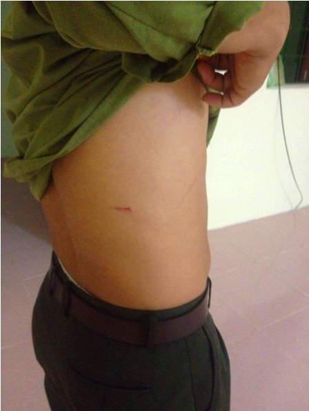 Lâm tặc liều lĩnh tấn công kiểm lâm, cướp gỗ tang vật