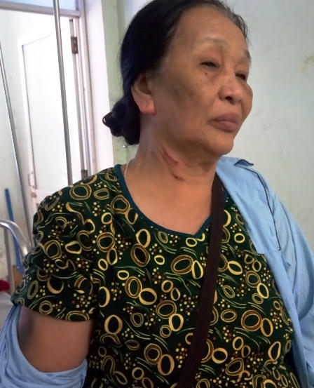 Kỷ luật giáo viên say xỉn đánh vợ chồng cựu chiến binh nhập viện