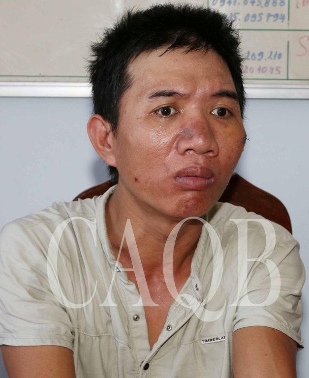 Khởi tố gã cuồng ghen đánh vợ bị thương rồi nhốt 3 con đòi thiêu sống