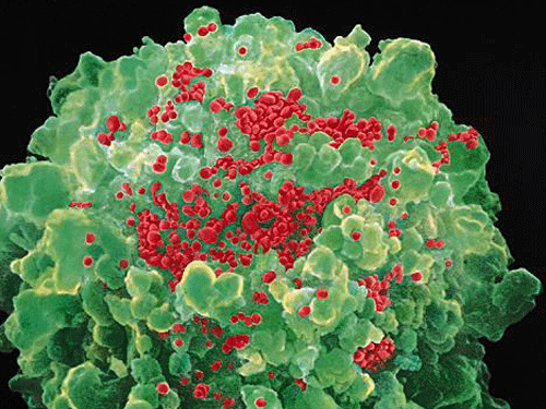 Phát hiện dòng HIV lan truyền rất nhanh tại Nga