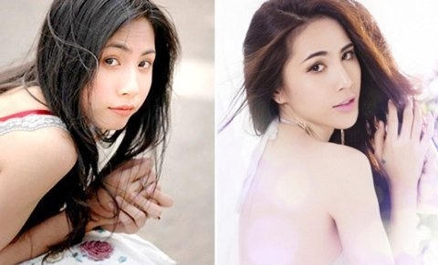 Sao và các kiểu “bơm” cứu sắc đẹp