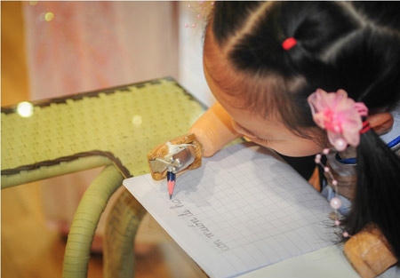 Cô bé không tay chân muốn được đi học