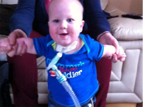 Bé trai có 12 ngón chân, 12 ngón tay