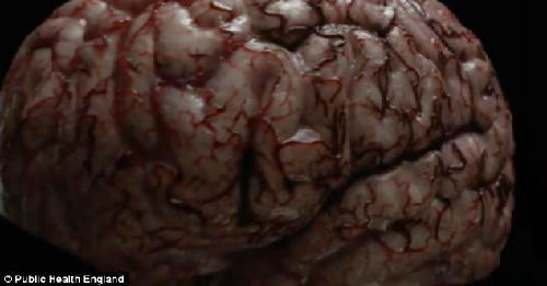 Hành trình phá hủy cơ thể khủng khiếp của thuốc lá 