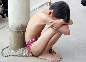 Luật khó bảo vệ trẻ em vì "vướng" tỷ lệ thương tích?