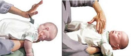 Xử trí khi trẻ hóc dị vật ngày Tết