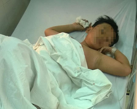 Một trẻ bị thủng bụng vì nghịch súng