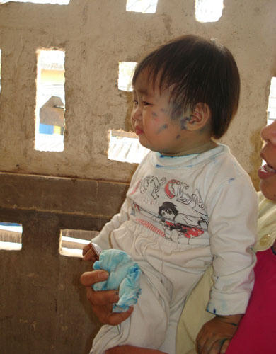 Phòng bệnh cho trẻ khi thủy đậu vào mùa