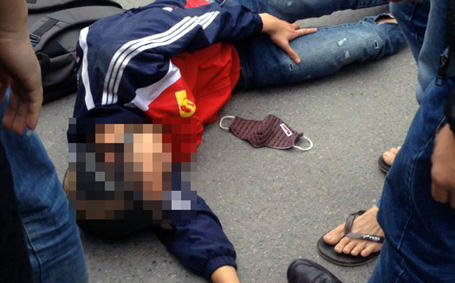 Ô tô lùi ẩu lôi một cô gái vào gầm