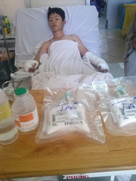 Cháy xém bộ hạ vì... thả diều 