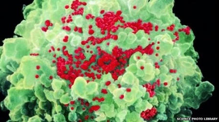 “Quan hệ” đồng tính nữ cũng lây HIV?