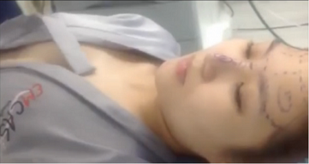 "Sao" sợ công khai chuyện sửa nhan sắc