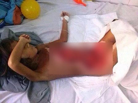 Người lớn bất cẩn, trẻ em "lĩnh" tai nạn thương tâm