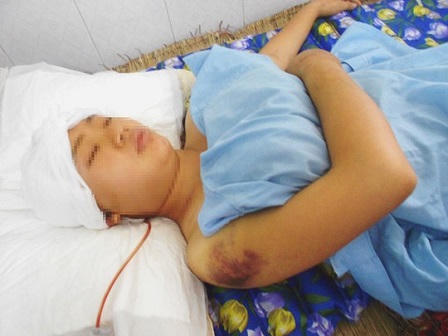 Con dâu vừa sinh con bị bố chồng chém nguy kịch