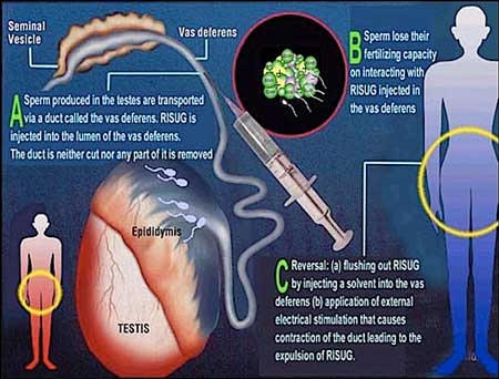 Sắp có thuốc tránh thai cho đàn ông