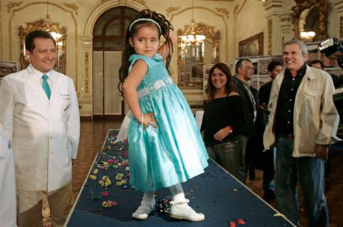 Hội chứng người cá của thai nhi