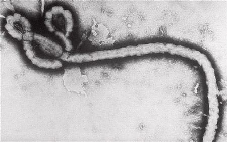 Ebola lây nhiễm qua đường tình dục?