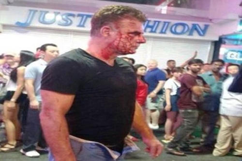 Từ chối “vui vẻ” với gái mại dâm, du khách bị hành hung