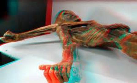 Ướp xác chờ hồi sinh: Giấc mơ có thật?