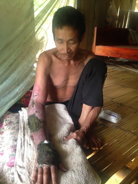 Kỳ lạ phương pháp chữa rắn cắn bằng thần chú ở Phú Thọ