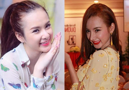 10 mỹ nhân Việt công khai thừa nhận dao kéo