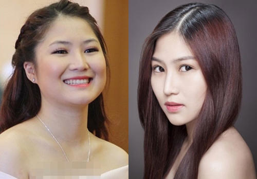 10 mỹ nhân Việt công khai thừa nhận dao kéo