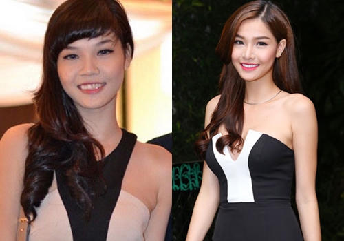 10 mỹ nhân Việt công khai thừa nhận dao kéo