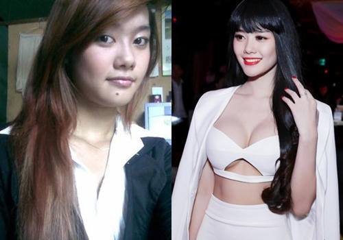 10 mỹ nhân Việt công khai thừa nhận dao kéo