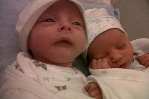 Anh em sinh đôi khác màu da - Triệu người mới có một!