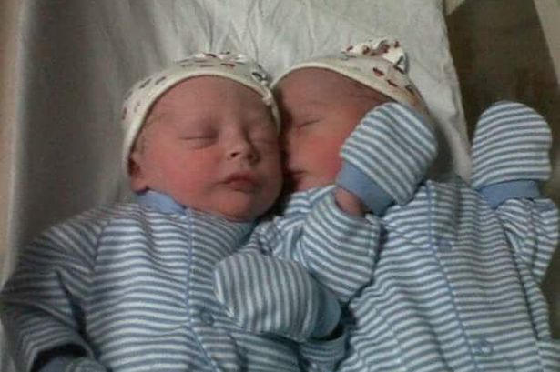 Anh em sinh đôi khác màu da - Triệu người mới có một!