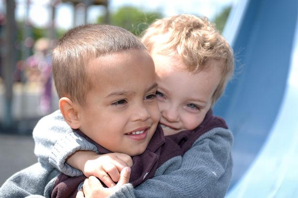 Anh em sinh đôi khác màu da - Triệu người mới có một!