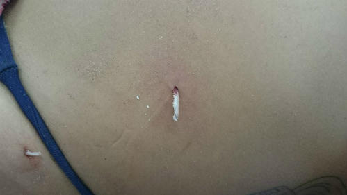 Du khách cấp cứu vì cá trê 'tấn công'