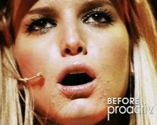 Bí quyết tiêu diệt mụn của các sao Hollywood