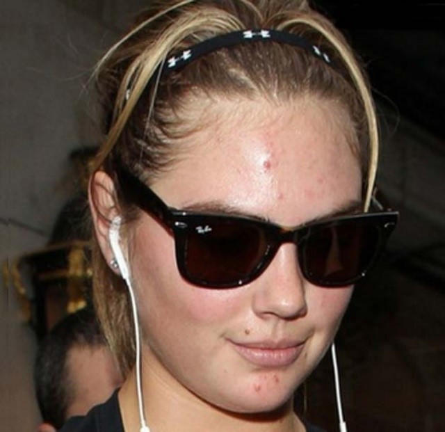 Bí quyết tiêu diệt mụn của các sao Hollywood